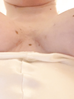SOLO TETTE