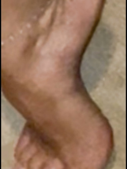 Troia dalla bocca ai piedi