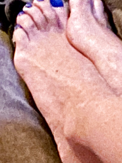 Troia dalla bocca ai piedi