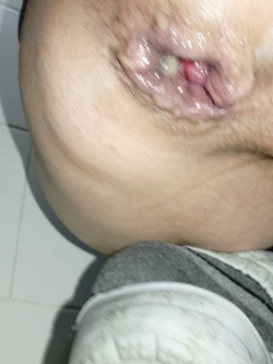 todos ass