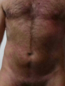 ....... Parte 2
