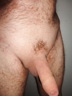 UN CARNOSO PREPUZIO