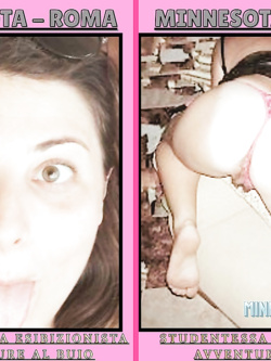 MINNESOTA - ESIBIZIONISTA ROMA