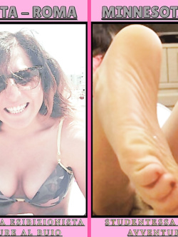MINNESOTA - ESIBIZIONISTA ROMA