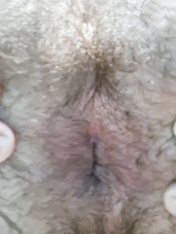 Il mio bellissimo buco del culo