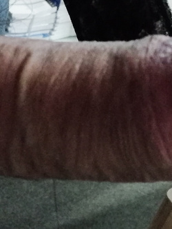Orgasmo anale