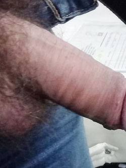 Orgasmo anale